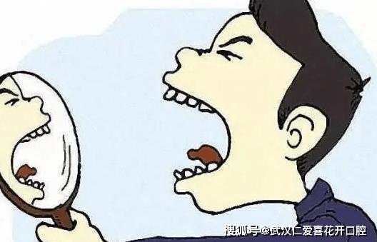 武漢仁愛口腔一位63歲蘇先生被確診為“頰粘膜高分化鱗癌”,罪魁禍首是遺留多年“殘根”
