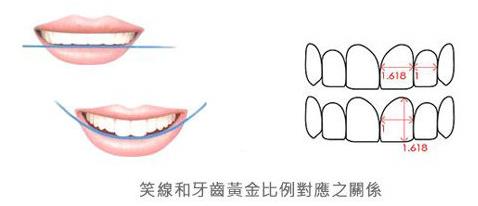 武漢仁愛(ài)口腔怎么樣?網(wǎng)友:為什么我笑的呆板顯老?牙醫(yī):牙齒矯正中不可忽視的微笑線!