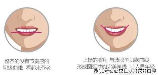 武漢仁愛(ài)口腔怎么樣?網(wǎng)友:為什么我笑的呆板顯老?牙醫(yī):牙齒矯正中不可忽視的微笑線!