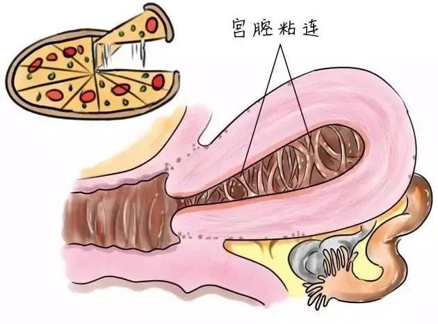 武漢仁愛婦產醫(yī)院:哇哦!不孕不育的隱藏殺手你知道是啥嗎?點進來看看