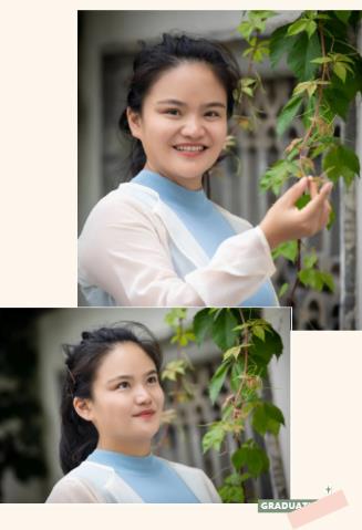 尖峰眼科全飛秒摘鏡,寶媽迎美麗蛻變!