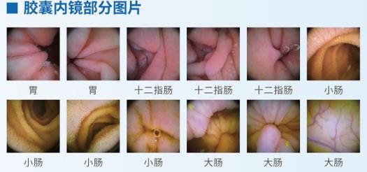 呼市東大肛腸醫(yī)院 這3個情況伴隨胃癌高危信號