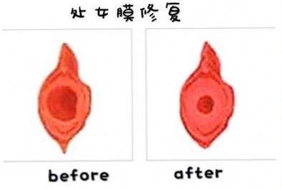 私密整形深受喜愛,選擇機(jī)構(gòu)需謹(jǐn)慎——成都瑪麗亞私密
