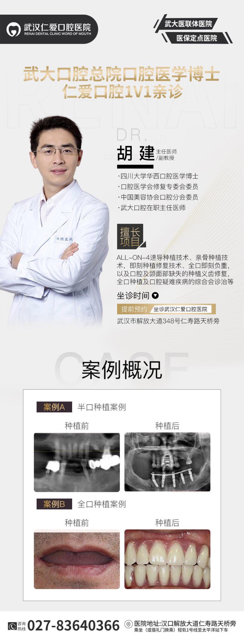 武漢仁愛(ài)口腔案例▏“微種植”當(dāng)天種牙當(dāng)天用!中秋節(jié)種牙預(yù)約爆滿!
