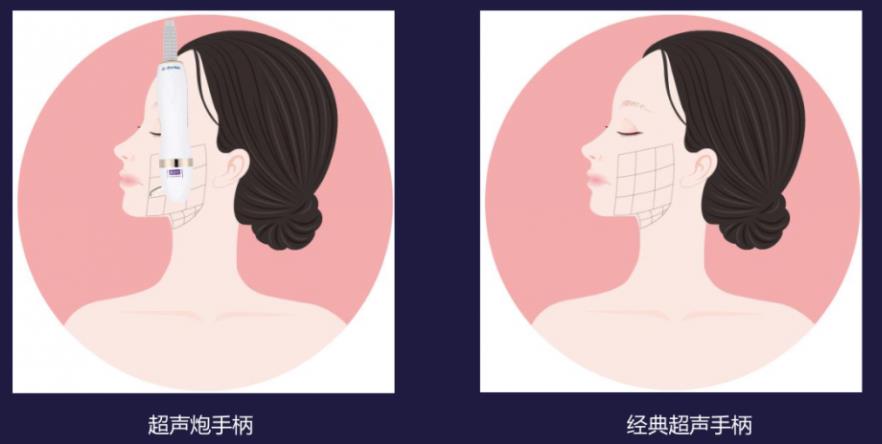 寧波藝星整形醫(yī)院:7D黃金超聲炮,深層抗衰,一次抵三次熱瑪吉!