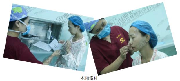 沈陽(yáng)杏林整形外科醫(yī)院自體脂肪面部填充費(fèi)用