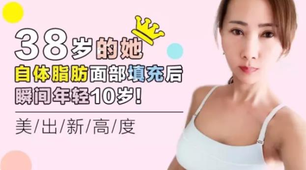 沈陽(yáng)杏林整形外科醫(yī)院自體脂肪面部填充費(fèi)用