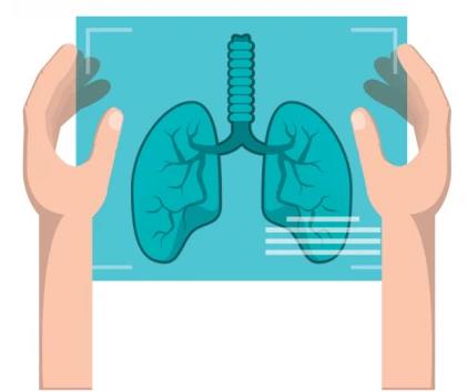 在什么情況下肺癌患者一定要做化療?