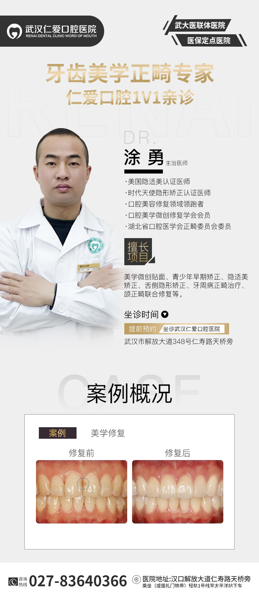 武漢仁愛(ài)口腔 數(shù)字化即刻美學(xué)貼面案例分享