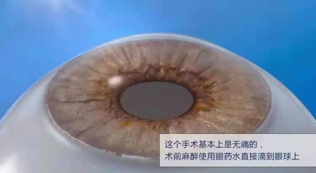 上海眼科專家化身主播,中秋佳節(jié)陪老人家共話白內(nèi)障、老花那些事
