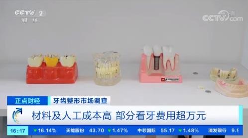 愛康齒科種植季| 種植牙貼心補貼,助缺牙人士重擁好口福,生活更幸福