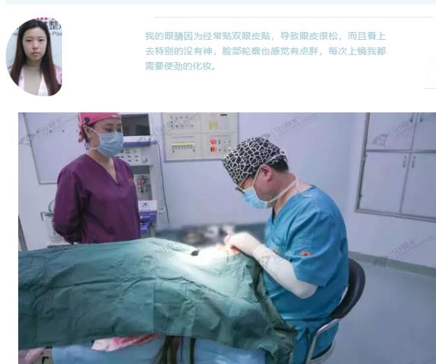 沈陽杏林整形外科醫(yī)院開眼角前后對(duì)比,有必要開眼角嗎
