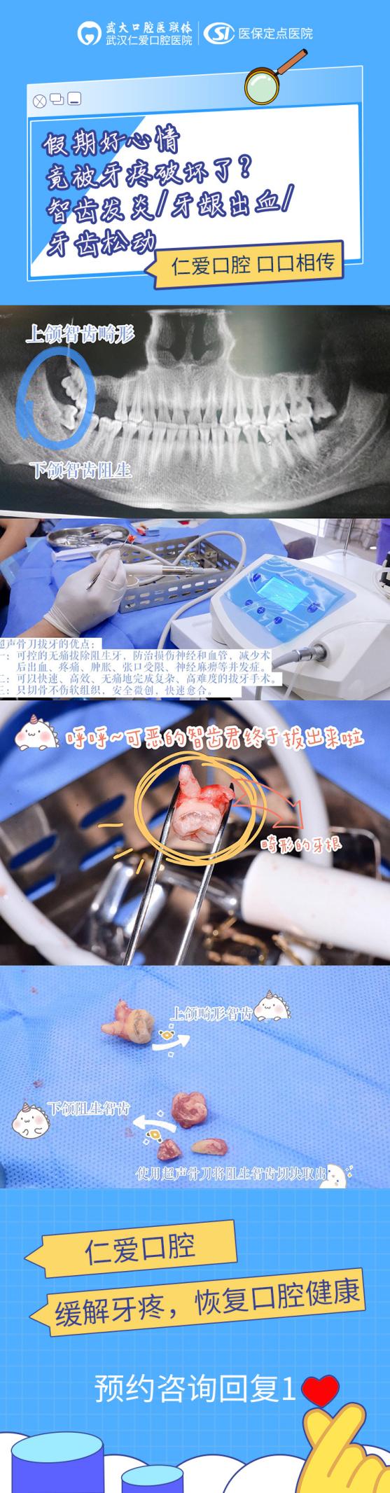 國(guó)慶假期去哪玩?不如來(lái)武漢仁愛口腔免費(fèi)看牙 還有驚喜福利等你拿