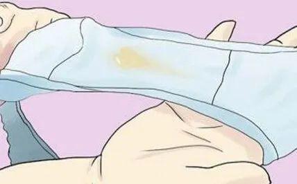 武漢仁愛(ài)醫(yī)院婦科:白帶為什么呈現(xiàn)豆腐渣樣子?