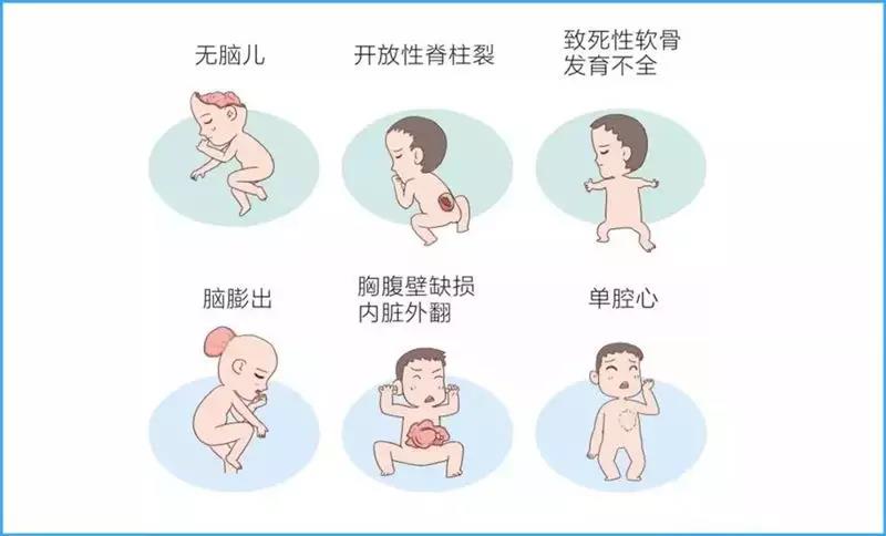 武漢仁愛婦產(chǎn)醫(yī)院:預(yù)防「胎兒畸形」準(zhǔn)爸媽應(yīng)守好「三道防線」!