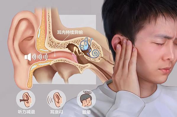 耳道瘙癢難忍又嗡嗡作響 成都民生耳鼻喉醫(yī)院講解是咋回事