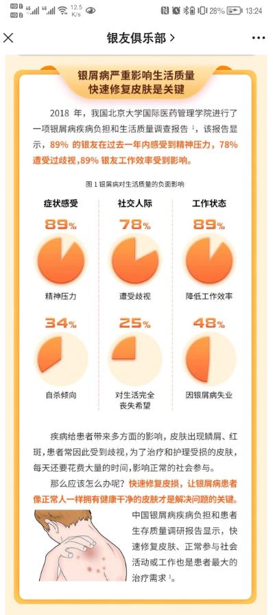 癬是怎么引起的?銀屑病人怎么看待它?