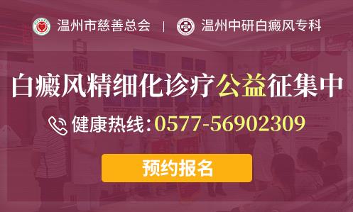 臺(tái)州白癜風(fēng)醫(yī)院好不好?白斑容易發(fā)生在哪些部位