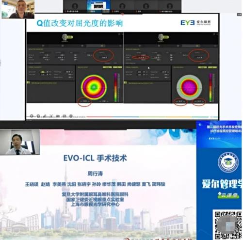 愛爾眼科屈光手術(shù)背后的“硬核”是什么?