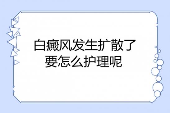 北京白癜風醫(yī)院王家懷:白癜風發(fā)生擴散了要怎么護理呢?