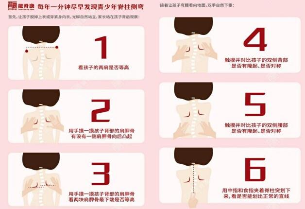 深圳龍脊康黃耿沛主任:脊柱側(cè)彎如何科學(xué)預(yù)防