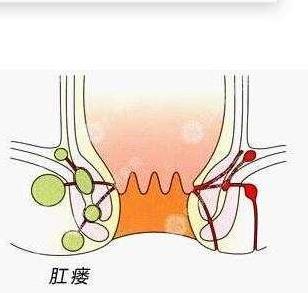 武漢江漢博仕醫(yī)院:肛周膿腫怎么治療?