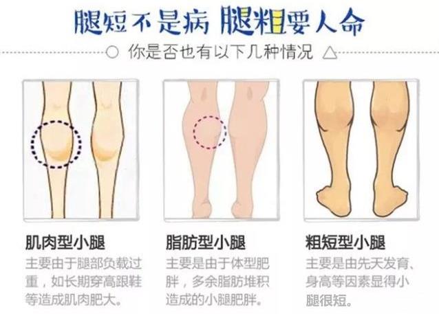 吸脂醫(yī)生關(guān)幾夢:吸脂瘦腿可以解決肥胖腿型嗎?