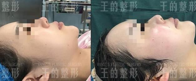 王的整形王海木院長告訴你:不同年齡段如何應對皮膚衰老?