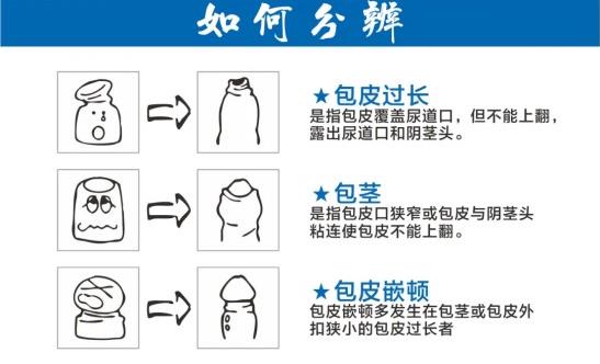喀什男科?漆t(yī)院有哪些?喀什曙光男科門診部好嗎?