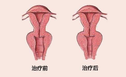 重慶哪家醫(yī)院可以改善產(chǎn)后同房性冷淡?