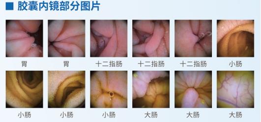 呼和浩特市東大肛腸醫(yī)院專家講解胃腸不好的表現(xiàn)