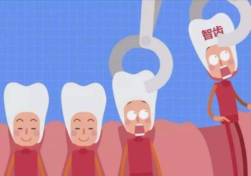 拔完牙止血棉可以不拿出來嗎?拔牙后棉花忘記拿掉了怎么辦