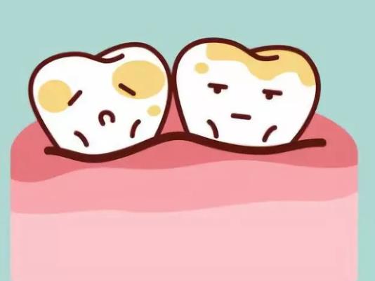 得了牙結(jié)石不想洗牙有別的方法嗎?洗了牙牙結(jié)石還會(huì)再有嗎