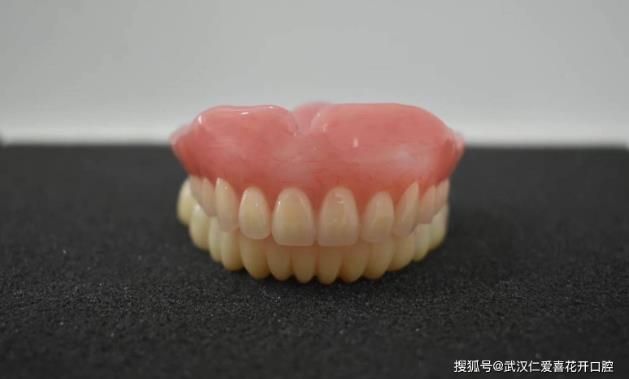 武漢口腔醫(yī)院修復(fù)案例像種植牙一樣“穩(wěn)固”的活動(dòng)假牙