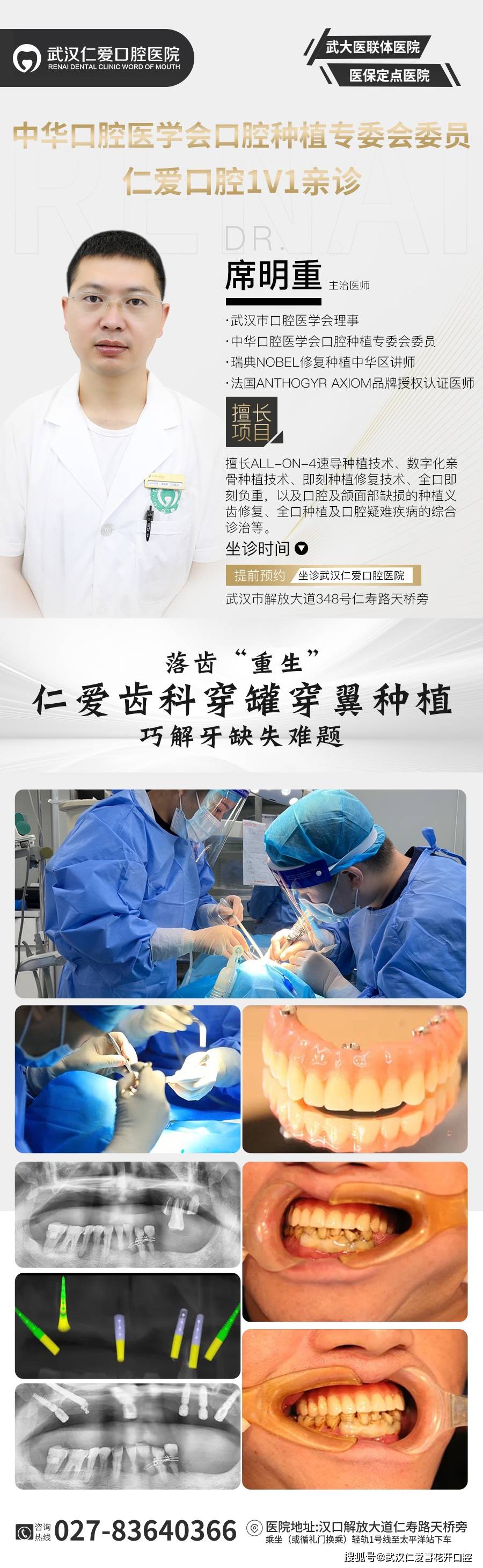 武漢口腔醫(yī)院修復(fù)案例像種植牙一樣“穩(wěn)固”的活動(dòng)假牙