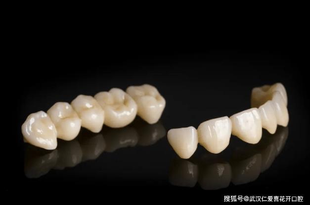 多年飽受牙黃牙丑苦惱,通過(guò)牙齒貼面——完美“蛻變”!