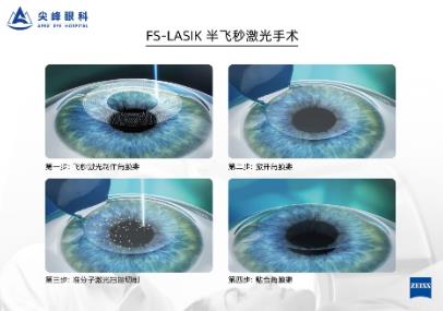 鄭州尖峰眼科:近視怎么通過參軍體檢?你可以試試這個(gè)辦法