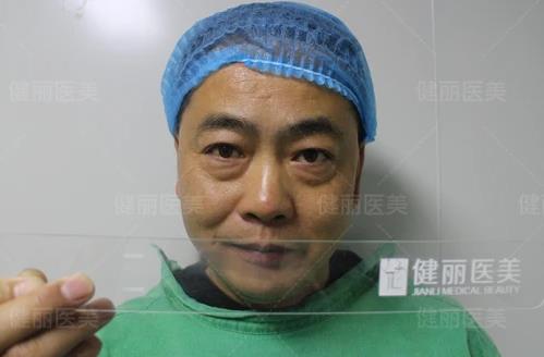 早睡、按摩、冰敷都不管用?健麗醫(yī)美幫你輕松去眼袋!