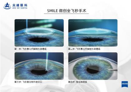 鄭州尖峰眼科:近視怎么通過參軍體檢?你可以試試這個(gè)辦法
