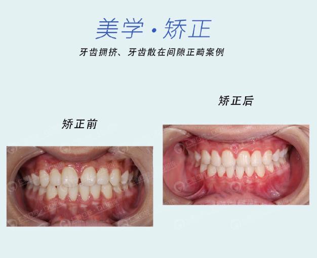 武漢仁愛口腔牙齒矯正技術(shù)好不好?