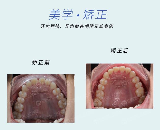 武漢仁愛口腔牙齒矯正技術(shù)好不好?