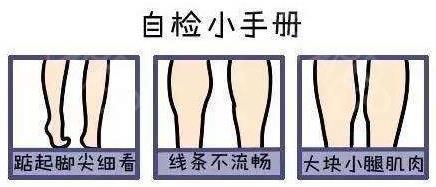 小腿吸脂為何是難點(diǎn)?廣州高尚形體雕塑來解疑