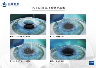 鄭州尖參軍體檢如何通過?你可以試試這個辦法——鄭州尖峰眼科