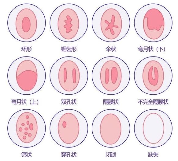 重慶哪家私密整形醫(yī)院做處女膜修復(fù)專業(yè)?