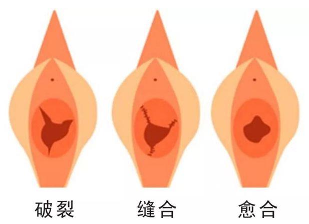 重慶哪家私密整形醫(yī)院做處女膜修復(fù)專業(yè)?