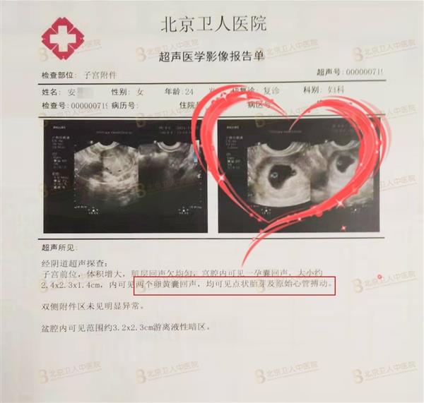 輸卵管只剩一側(cè)還能懷孕嗎?河北小紅僅一側(cè)輸卵管在北京衛(wèi)人醫(yī)院喜獲雙胎