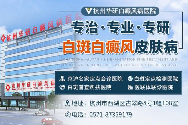 杭州華研白癜風(fēng)醫(yī)院治療的好嗎?