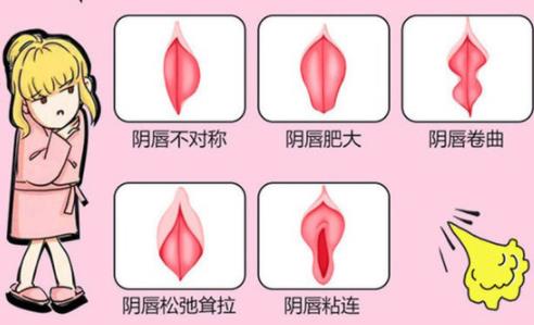 重慶哪家可以做陰唇整形手術(shù)?