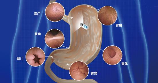 呼和浩特市東大肛腸醫(yī)院 胃鏡檢查很痛苦?五個胃鏡認識誤區(qū)你別“踩”