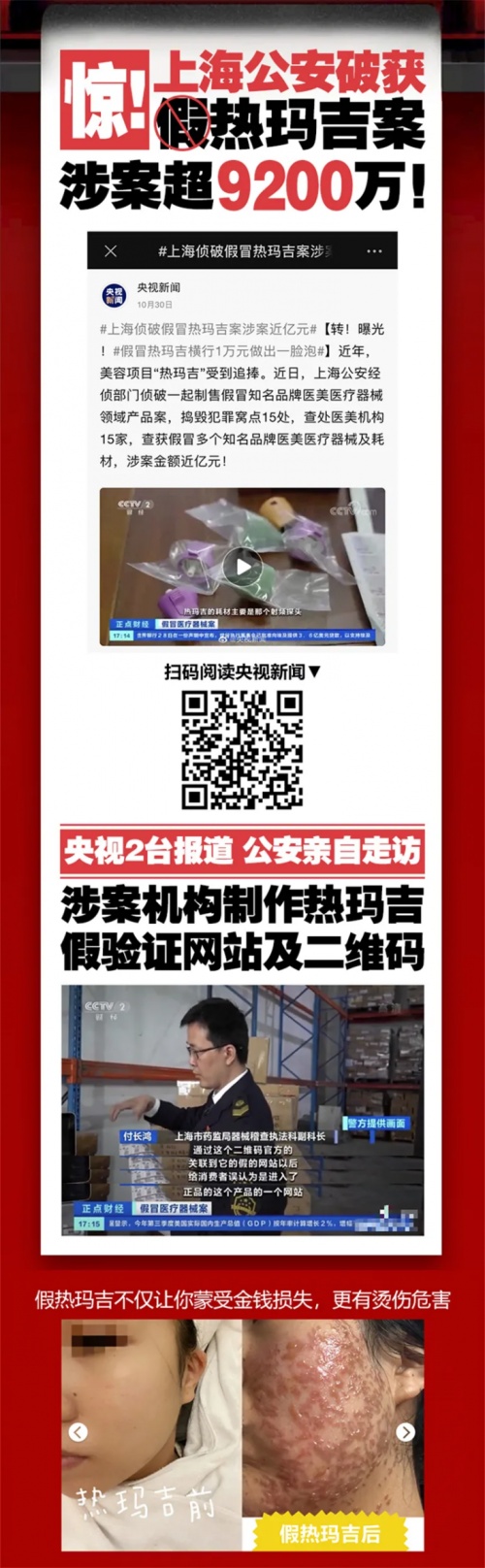 福州海峽整形攜手熱瑪吉廠家開(kāi)展福建首屆凍齡計(jì)劃活動(dòng)圓滿成功!